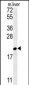 GM2A Antibody (N-term)