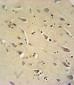 TC10 Antibody (Center)
