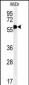 TANK Antibody (Center)