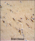 ARF1 Antibody (Center)