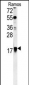 ARF1 Antibody (Center)