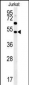 SAMSN1 Antibody (Center)