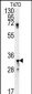 SIAH2 Antibody (Center)