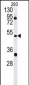 ILKAP Antibody (Center)