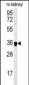 ILKAP Antibody (Center)