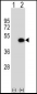 ILKAP Antibody (Center)