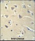 PENK Antibody (Center)