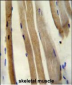 CS Antibody (N-term)