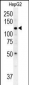 ATP13A3 Antibody (N-term)