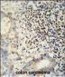 ESRP1 Antibody (N-term)