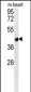 PTGR1 Antibody  (Center)