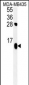 ATP5D Antibody (N-term)