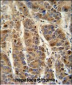 C4BPA Antibody (C-term)