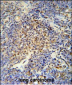 OTUD4 Antibody (N-term)