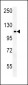 OTUD4 Antibody (N-term)