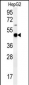 PDHA1 Antibody