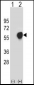 PDHA1 Antibody