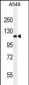 RET Antibody (Ascites)