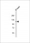 RET Antibody (Ascites)