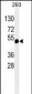 PAX6 Antibody (Ascites)