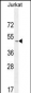 SELPLG Antibody (C-term)