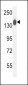 COL19A1 Antibody (N-term)