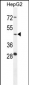 CTSA Antibody (N-term)