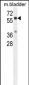 CTSA Antibody (N-term)