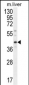 DNAJC11 Antibody (N-term)