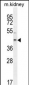 E2F2 Antibody (Center)