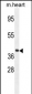 GNA15 Antibody (C-term)