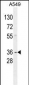 GNAT3 Antibody (Center)