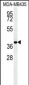 CCR8 Antibody (C-term)