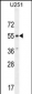 CMKOR1 Antibody (C-term)