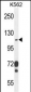 ITGAE Antibody (C-term)