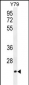 TCAL3 Antibody  (N-term)