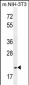 TCAL3 Antibody  (N-term)