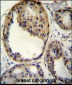 AKT1 (Thr308) Antibody
