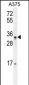 PUSL1 Antibody (C-term)