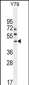 LACE1 Antibody (N-term)