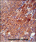 CES2 Antibody (Center)