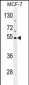 CES2 Antibody (Center)