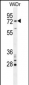 BARD1 Antibody (N-term)