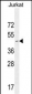 CD34 Antibody (Center)