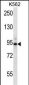 CCNT1 Antibody (Center)