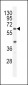 ACF Antibody (C-term)