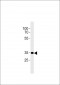 CB2 Antibody (C-term)