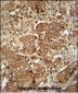 APCS Antibody (C-term)