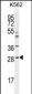 APCS Antibody (C-term)