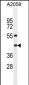 HLA-B Antibody (Center)